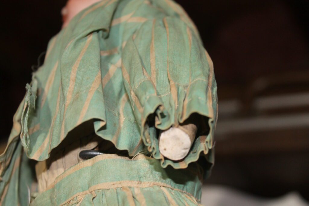 Doll "rehabbers" do exist, I'm sure a prosthetic could be engaged here.